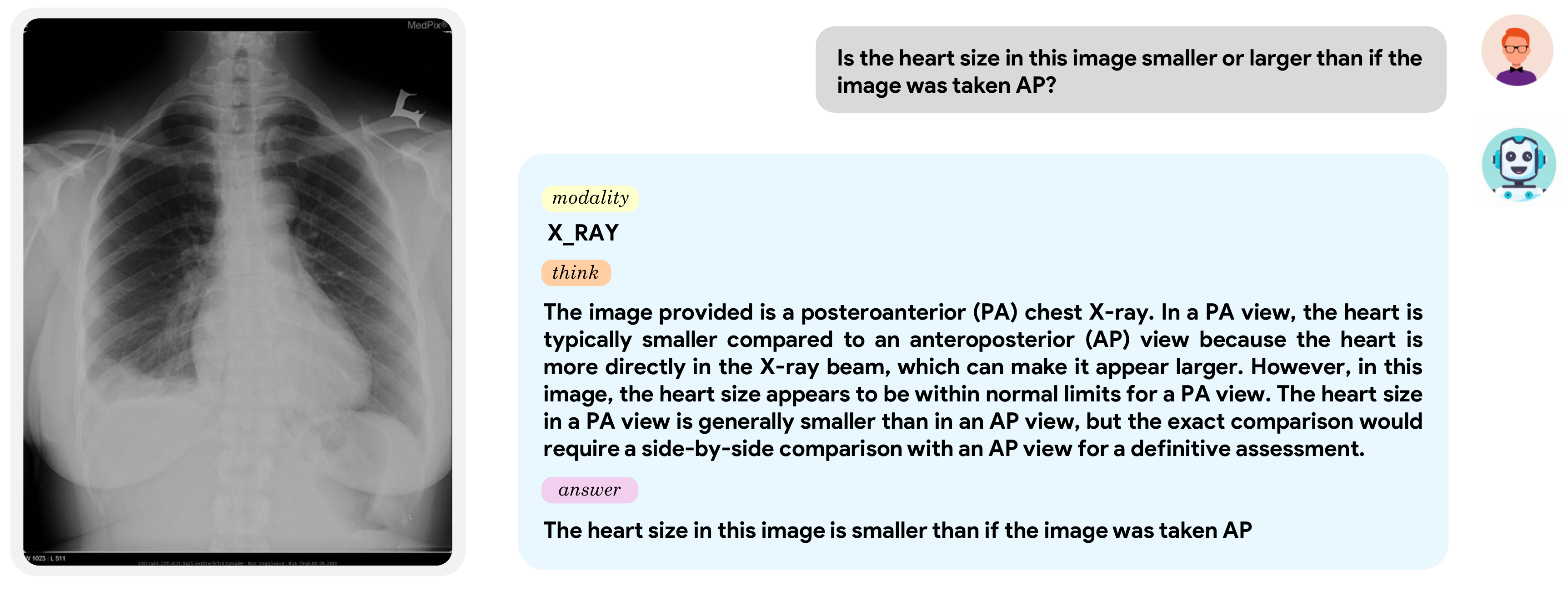 X-ray Example