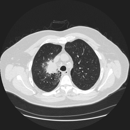 source_xmlab106.jpg