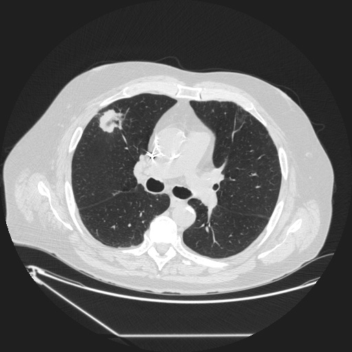 source_xmlab119.jpg