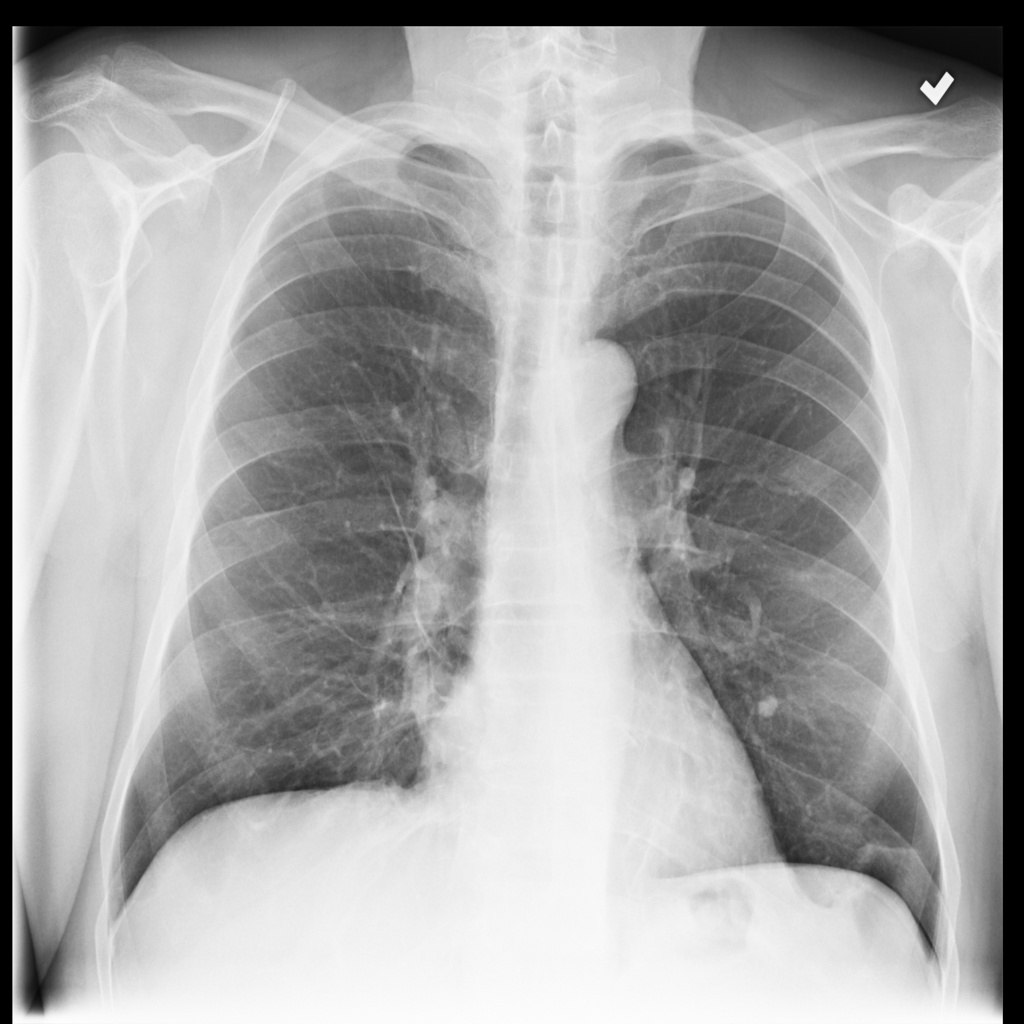 source_xmlab125.jpg