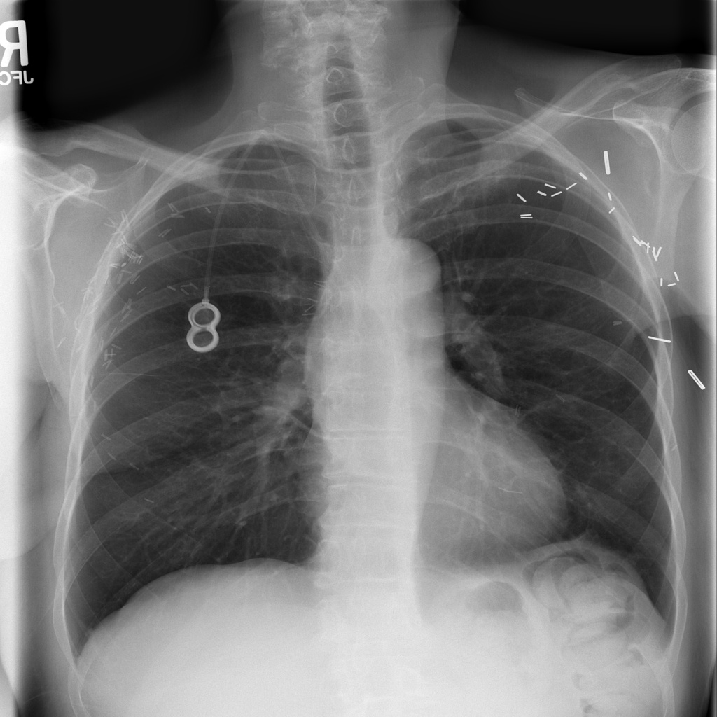source_xmlab126.jpg