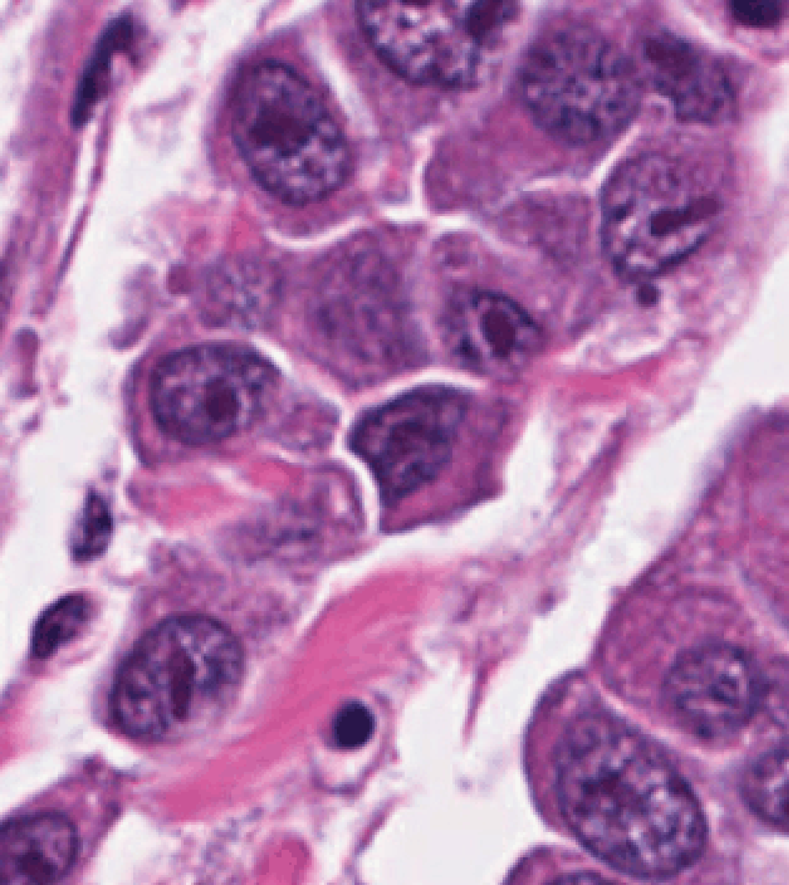 Graph-NuCLS teaser – cell-graph construction from a histopathology patch