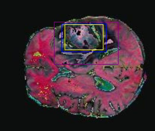 brainbbox.png
